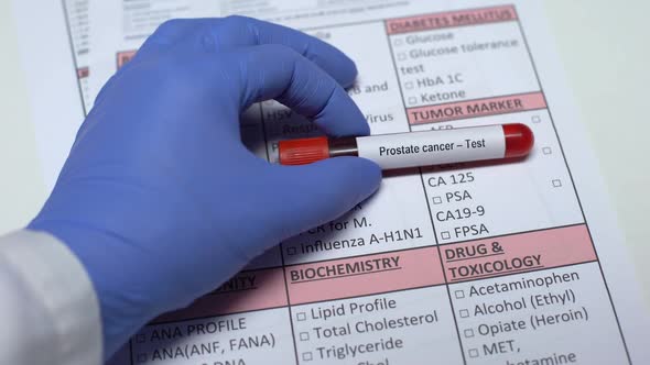 Prostate Cancer, Doctor Checking Diseases in Lab Blank, Showing Blood Sample alt