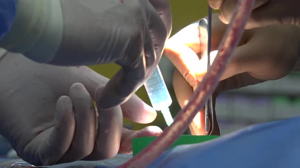 Back Surgery Or Minimally Invasive Spine Surgery 
