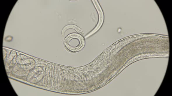 The Female Roundworm Turbatrix Aceti Gave Birth To Two Nematodes Formed ...