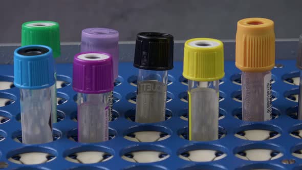 Empty test tubes with colorful caps in a tray on a blue background