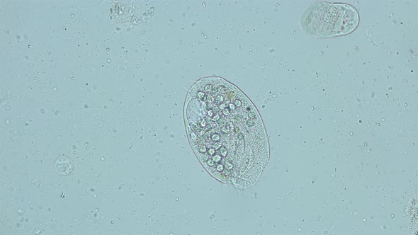 infusorium Ciliophora Subclass Hypotrichia under a microscope, Class Spirotrichea alt