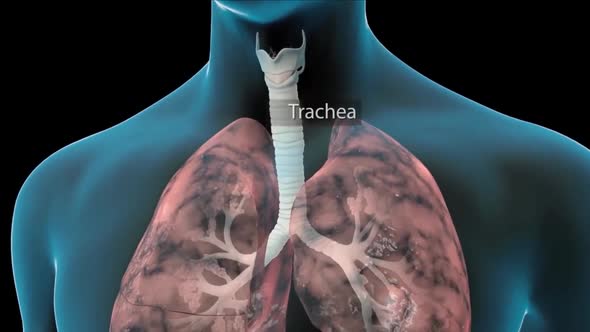 damaged lung anatomy 3d medical alt