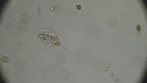 Microscopy: Lepadella Rotifers