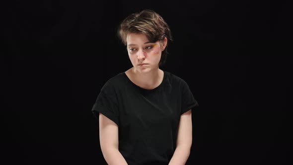 Young Brunette Woman Turning Face with Bruises and Looking at Camera alt