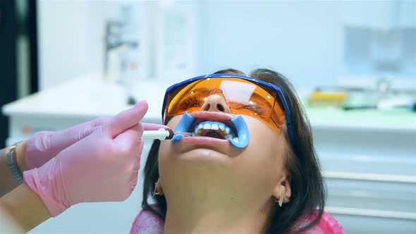 Dentist Applies Whitening Gel To Patient's Teeth