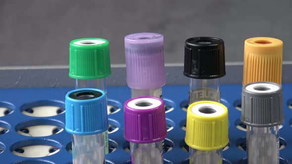 Plastic test tubes with caps for the collection of samples. Test tube rack. Medical modern medicine