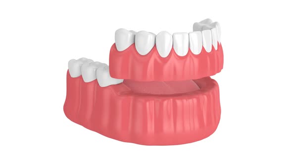 Partial denture isolated over white background