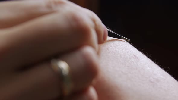 Removing Body Hair Tweezers alt