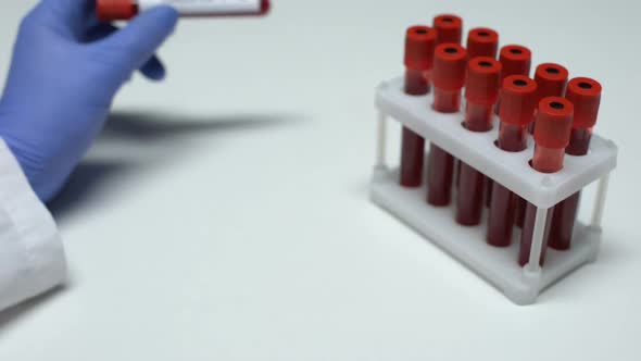 Positive Coxsackie Virus, Doctor Showing Blood Sample in Tube, Lab Research alt