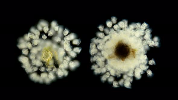 Vorticella Colony Under a Microscope alt