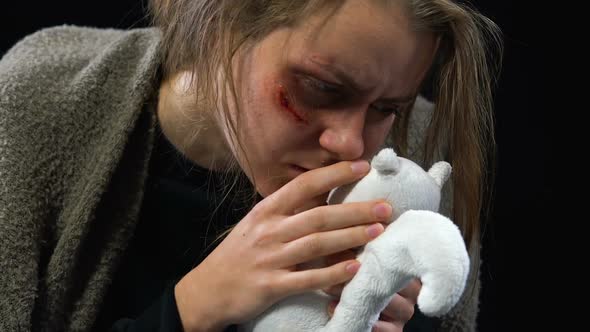 Bruised Woman Hugging Toy, Victim of Kidnapping Missing Family, Physical Abuse alt