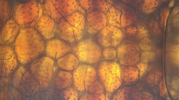 Bed Bug Cimex Lectularius Under a Microscope alt