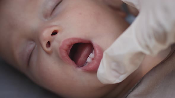 Doctors Hands Check Sleeping Baby Infant First Milk Teething in Gums Dentition alt