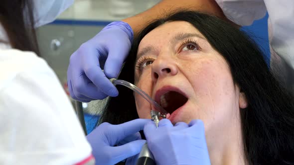 Dentist Polishes Client's Lower Teeth