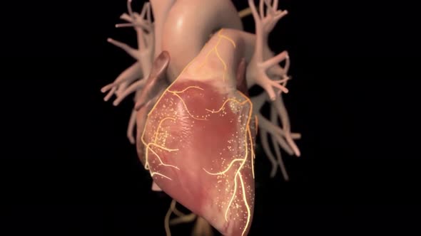 Animated Congestive Heart Failure 3d alt