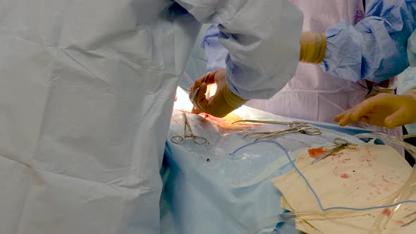 During the Surgical Operation the Doctor Removes Blood From the Wound ...