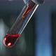 Exporting sample blood into a test tube - VideoHive Item for Sale