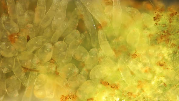 Colony Rotifers Philodina Sp. Under a Microscope, Family Philodinidae, Class Bdelloidea, Mainly alt