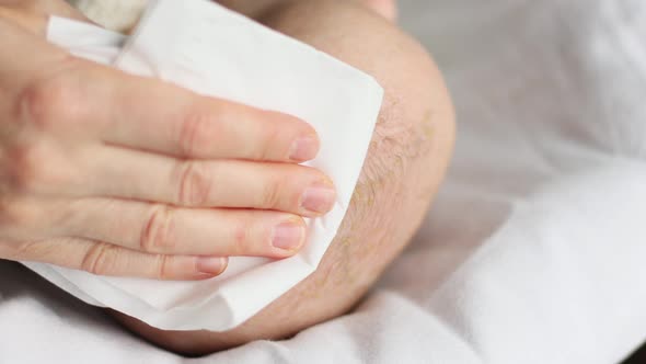 Seborrheic Dermatitis Treatment Removing Dandruff Flakes Off Infant Baby Head alt