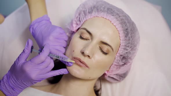 A beautician in gloves makes botox injections to the upper and lower parts of the lips alt