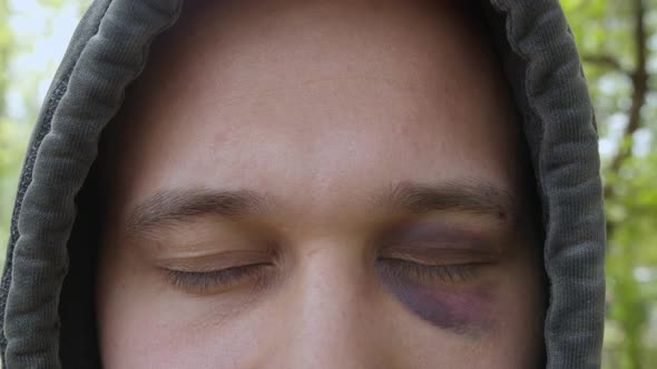 Sad Man in Hood with Bruise and Abrasions Under the Eye