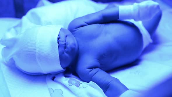 Newborn Having a Treatment for Jaundice Under Ultraviolet Lamp in Home Bed alt
