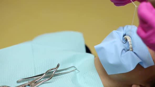 Tooth whitening. Application of the latest technology, cold whitening of teeth alt