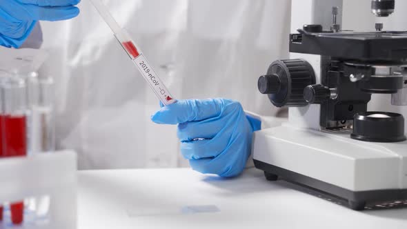 A Scientist in the Laboratory Uses a Microscope To Study a Blood Test alt