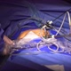 Laparoscopic Surgery - VideoHive Item for Sale