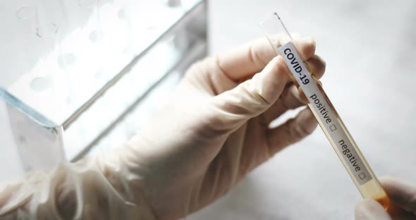 Doctor holding a coronavirus COVID-19 test tube