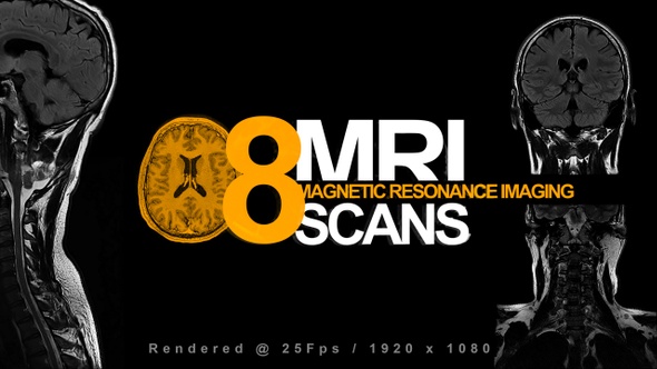 MRI Scan Elements Pack
