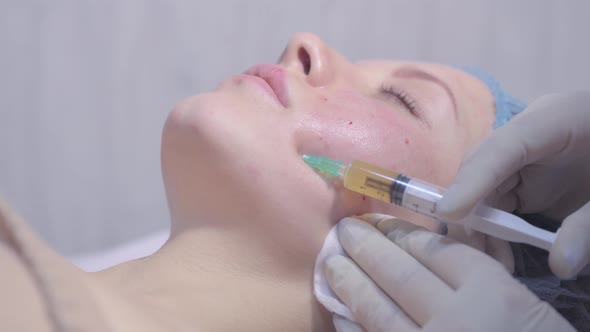 Woman on the Procedure of Mesotherapy Injection