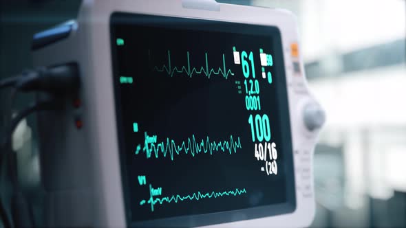 Heart Rate Monitor in Hospital Theater. Medical Vital Signs Monitor Instrument in a Hospital alt