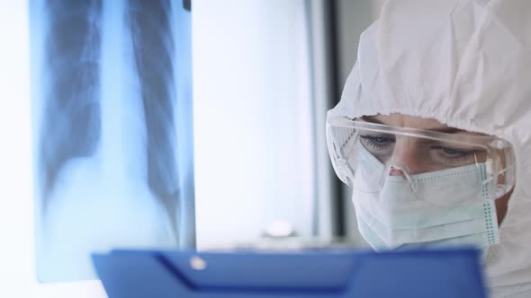 Video of doctor checking lungs x-ray. Shot with RED helium camera in 8K alt
