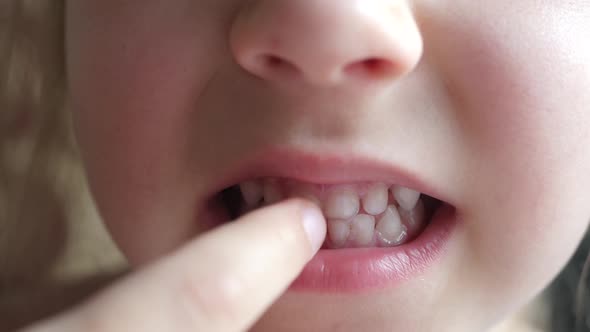 Girl Child Shows First Milk Temporary Tooth