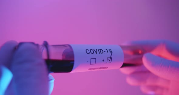 Doctor looking at a COVID-19 test tube analysis