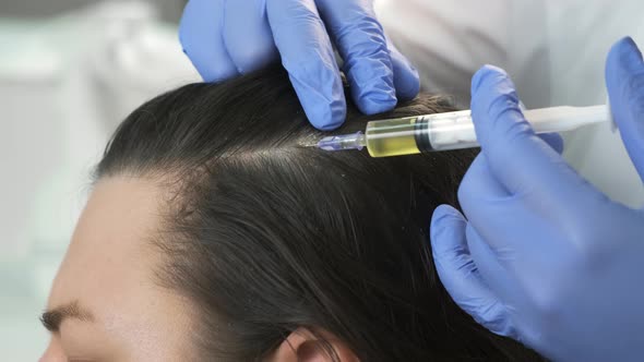 Doctor Trichologist Makes Injections Woman's Skin Head Hair Growth