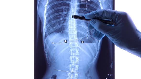 Doctor Analyzing X Ray of the Spine