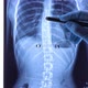 Doctor Analyzing X Ray of the Spine - VideoHive Item for Sale