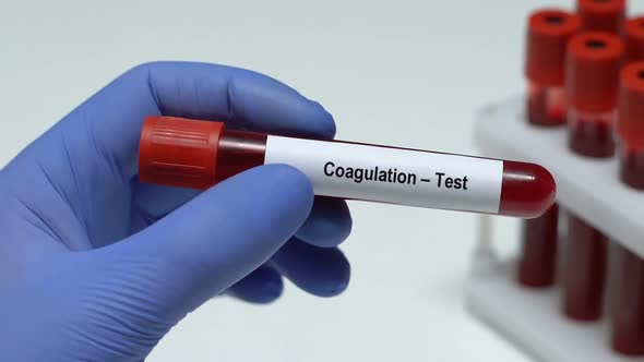 Coagulation-Test, Doctor Holding Blood Sample in Tube Close-Up, Health Check-Up alt
