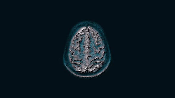 Voluminous Color MRI Brain, Head Scans and Tumor Detection. Diagnostic Medical Tool alt