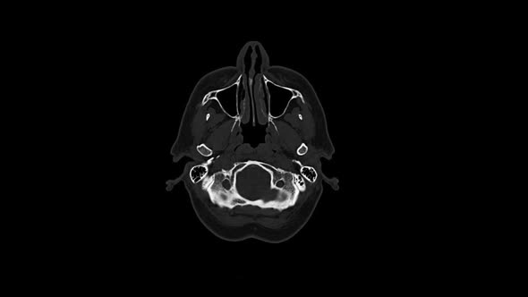 Computed Medical Tomography MRI Scan of Old Female Head. Top View