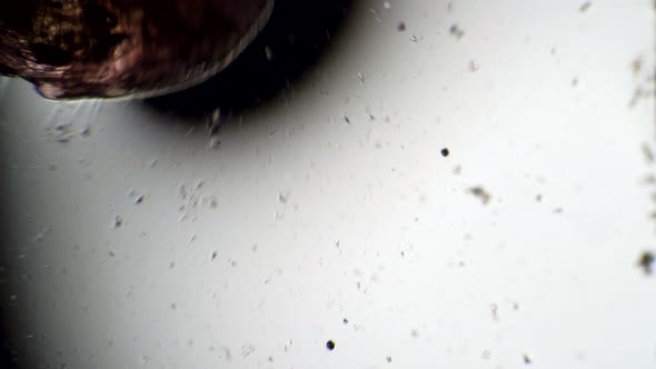 A Restless Worm Moves in the Microscope alt