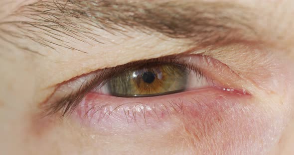 Close up of a man's eye alt