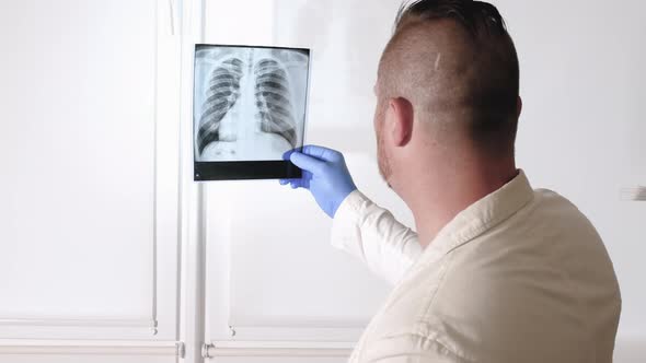 Tuberculosis On A Human Lung X Ray. The Doctor Analyzes The X Ray Of The Lungs On A White Background