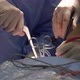 Minimally Invasive Spine Surgery - VideoHive Item for Sale