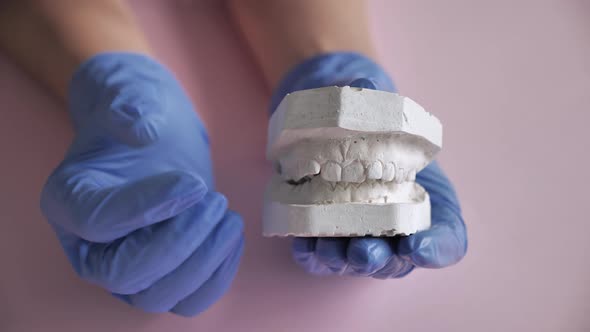 Gypsum 3 d Model Instrument Dentist Treatment Inspection Teeth Braces alt