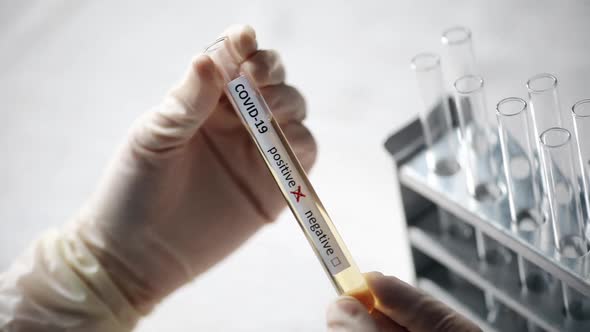 Doctor holding a coronavirus COVID-19 test tube