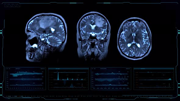 Futuristic Brain MRI Scan