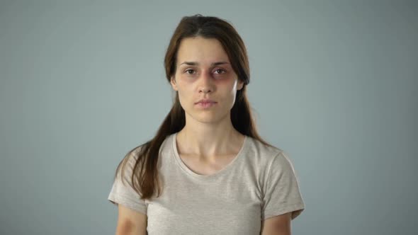 Bruised Woman Holding Me Too Sign in Hands, Sexual Harassment Prevention alt